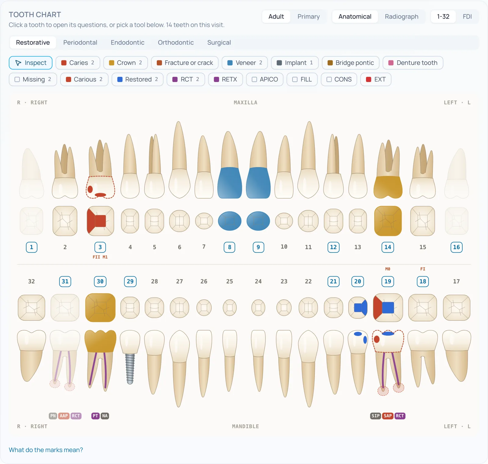 Envera interactive tooth chart with restorative, endodontic and surgical tools