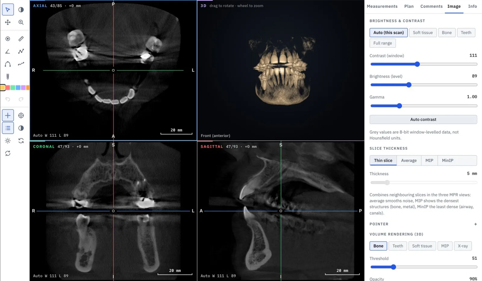 Envera Vision CBCT viewer with axial, coronal and sagittal views and a 3D rendering of the teeth