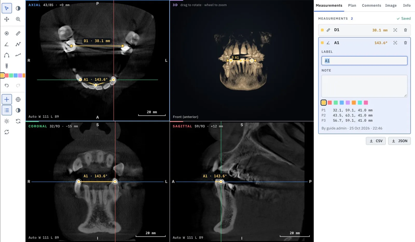 Envera Vision measurements panel with distance and angle annotations on all views